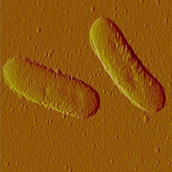 باکتری تیوباسیلوس